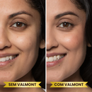 Base Profissional - Valmont™ [Compre 1 & Leve 2]