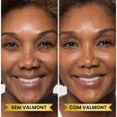 Base Profissional - Valmont™ [Compre 1 & Leve 2]